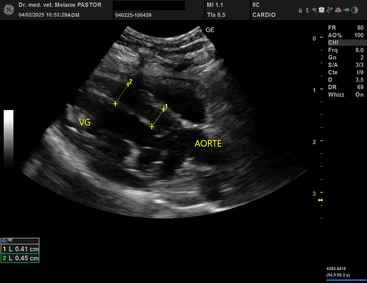 echocardiographie